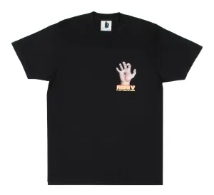 RBM V TEE